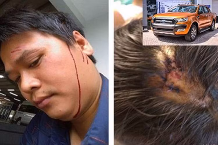 Mới đây nhất, trên cộng đồng mạng xôn xao trước vụ việc một khách hàng có nickname Vũ Tuấn bị nhân viên sửa chữa tại đánh hội đồng chảy máu đầu dẫn tới phải đi bệnh viện băng bó vết thương. Theo thông tin ban đầu, anh Tuấn mang chiếc bán tải Ford Ranger đến gara Ford An Đô số 168 Phạm Văn Đồng sửa chữa và xảy ra xô xát.