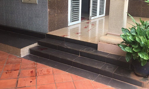 Em trai ban chet chi dau, anh trai bi thuong ke nguyen do-Hinh-2