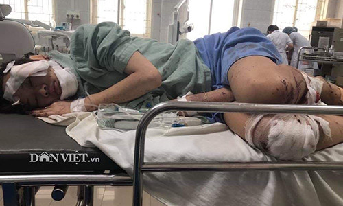 Tai nan tham khoc o Hoa Binh: Me chet lang nghe tin 2 con thuong vong-Hinh-2