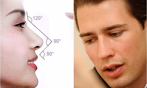 Nhan tuong hoc: Nhung nguoi giau co thuong co tuong mui nay