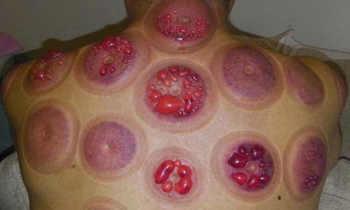 Vo bi bong vi nua dem ve sang duoc chong giac hoi