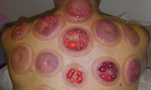 Vo bi bong vi nua dem ve sang duoc chong giac hoi