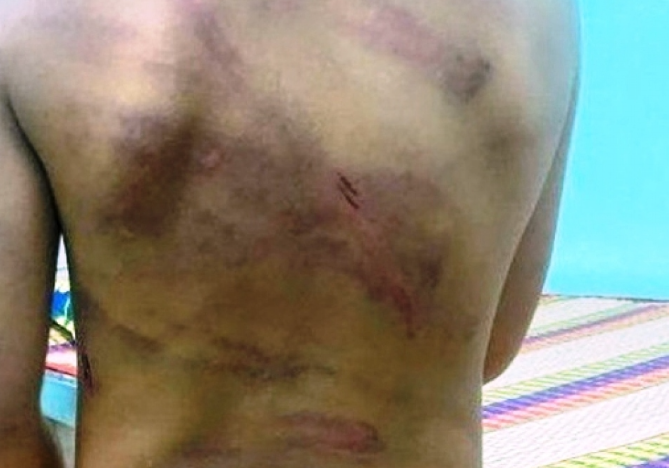 Tháng 2 vừa qua, Lầu đón con riêng là bé Y. đến ở chung. Thấy bé Y. thường nghịch đồ dùng cá nhân của Tú và biếng ăn nên Tú và Lầu nhiều lần đánh bé gái gây thương tích. Ngày 27/7, hàng xóm phát hiện trên người bé D. có vết bầm tím, trầy xước nên trình báo công an. Thời điểm lực lượng chức năng đến nhà kiểm tra, cơ thể bé gái bị bầm tím từ đầu đến chân, vết thương vùng mông rách da gây chảy máu. Công an xã Tân Hòa đã mời Lầu Y Lầu và Trần Thanh Tú về làm việc. Tại đây, cả hai khai nhận hành vi đánh đập bé gái.