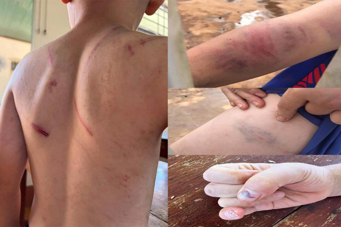  Bố và bà nội bạo hành dã man bé trai 9 tuổi ở Đắk Lắk: Ngày 25/7, Công an huyện Cư Kuin (tỉnh Đắk Lắk) đã khởi tố vụ án, khởi tố bị can đối với bà nội và cha ruột trong vụ cháu T.N.A. (9 tuổi) bị bạo hành để điều tra về "Tội cố ý gây thương tích" hoặc "Gây tổn hại cho sức khỏe của người khác". Hiện cả 2 bị can là ông T.V.D. (cha ruột cháu A.) và bà T.T.T. (bà nội cháu A.) được tại ngoại nhưng bị cấm đi khỏi nơi cư trú để phục vụ công tác điều tra. 