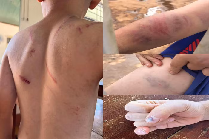  Bố và bà nội bạo hành dã man bé trai 9 tuổi ở Đắk Lắk: Ngày 25/7, Công an huyện Cư Kuin (tỉnh Đắk Lắk) đã khởi tố vụ án, khởi tố bị can đối với bà nội và cha ruột trong vụ cháu T.N.A. (9 tuổi) bị bạo hành để điều tra về "Tội cố ý gây thương tích" hoặc "Gây tổn hại cho sức khỏe của người khác". Hiện cả 2 bị can là ông T.V.D. (cha ruột cháu A.) và bà T.T.T. (bà nội cháu A.) được tại ngoại nhưng bị cấm đi khỏi nơi cư trú để phục vụ công tác điều tra. 