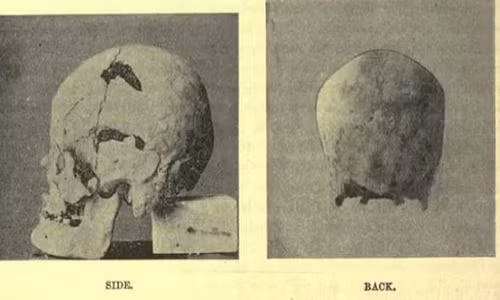 Nằm trong nghiên cứu về xác ướp, các nhà khoa học đã tiến hành phân tích, kiểm tra một xác ướp được phát hiện năm 1901 tại một ngôi mộ gần Beit Khallaf, Ai Cập. Kết quả nghiên cứu cho thấy xác ướp này có niên đại vào khoảng năm 2700 TCN.
