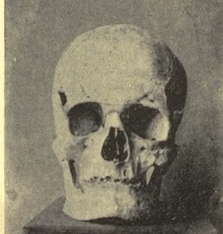 Bộ hài cốt có chiều cao cơ thể gần 2m mà các nhà khoa học phân tích lớn hơn rất nhiều so với Ramsses II, pharaoh Ai Cập cao nhất được ghi nhận, người sống sau Sa-Nakht hơn 1.000 năm và chỉ cao 1,75m. Trong nghiên cứu đăng đầu tháng 8 trên tạp chí The Lancet Diabetes &amp; Endocrinology, nhà Ai Cập học Habicht phân tích lại hộp sọ và bộ xương của pharaoh Nakht.