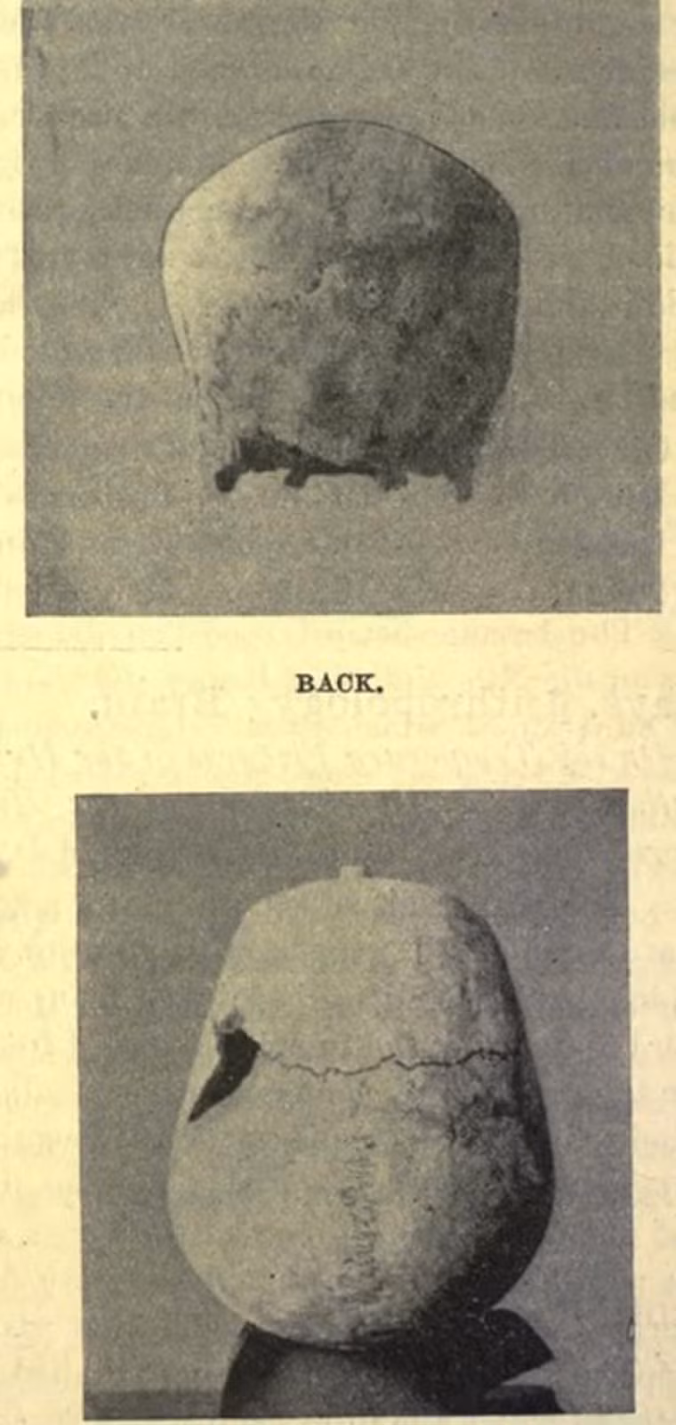 Các nhà khoa học tiết lộ bộ hài cốt trên thuộc về một người đàn ông có chiều cao lên đến 1,987m và được cho là Sa-Nakht - pharaoh Ai Cập thuộc triều đại thứ ba. Chiều cao của pharaoh Sa-Nakht lớn hơn so với người bình thường.