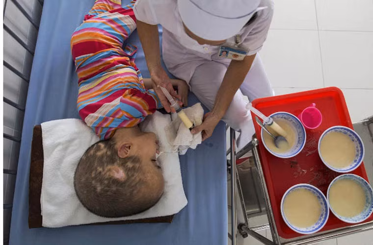 Pham Thi Phuong Khanh được nhân viên y tế chăm sóc tại Làng Hòa Binh, bệnh viện Từ Dũ, TP. HCM. Bố mẹ của Khanh đều bị phơi nhiễm chất độc da cam/dioxin.