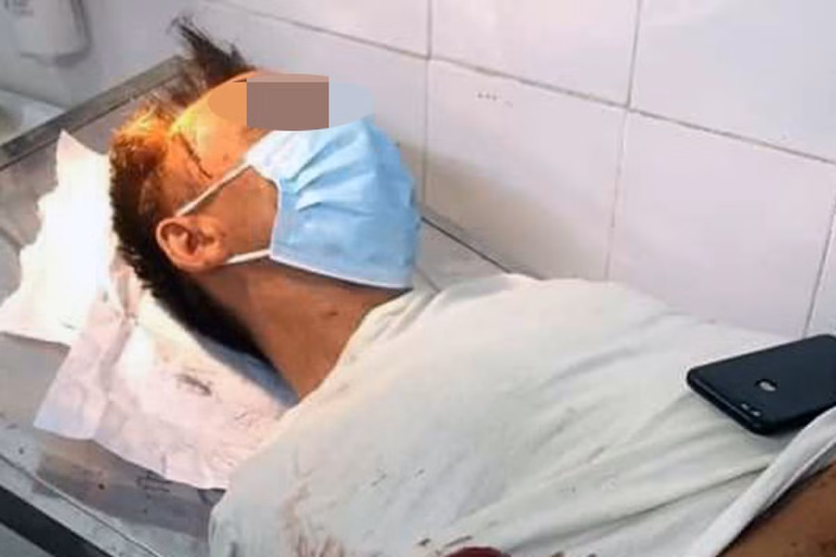  Vợ chém chồng hàng chục nhát dao: Sáng 21/7/2021, người dân khu 10, xã Hướng Đạo (huyện Tam Dương, Vĩnh Phúc) phát hiện một người đàn ông bị chém gục. Theo người dân địa phương, người gây thương tích cho người đàn ông chính là vợ của ông ta. Hai vợ chồng ông H. thường xuyên có mâu thuẫn, cãi vã.