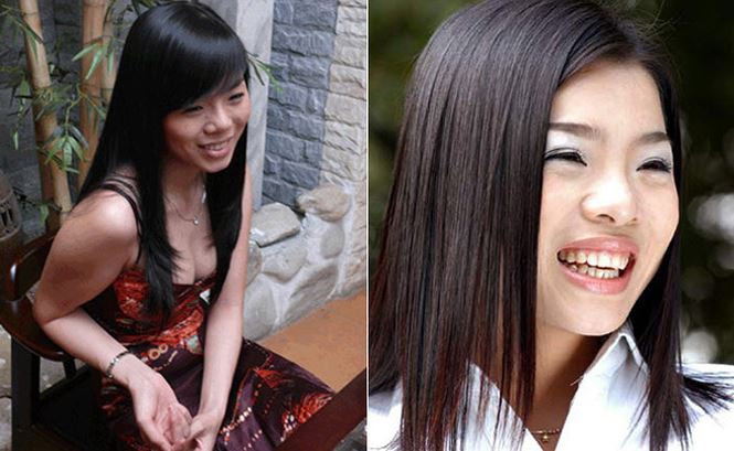 Ngay sau khi công khai chuyện tháo sụn mũi, hình ảnh mới nhất của nữ ca sĩ chia sẻ trên trang cá nhân khiến nhiều người không khỏi giật mình bởi hình ảnh này hoàn toàn khác Lệ Quyên trước khi phẫu thuật nâng mũi và sau khi đã nâng mũi.