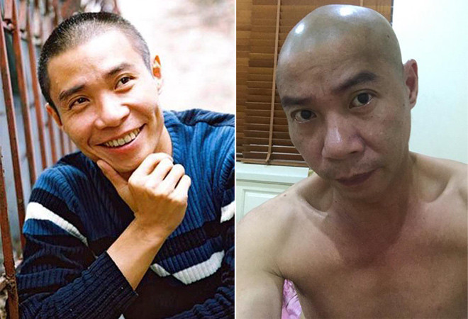 Giữa tin đồn sắp cưới bạn gái mới, nghệ sĩ Công Lý vẫn giữ im lặng. Mới đây anh bất ngờ chia sẻ kiểu đầu mới khiến nhiều người bất ngờ. Công Lý để đầu trọc, mình trần, tự chụp hình trong phòng riêng.