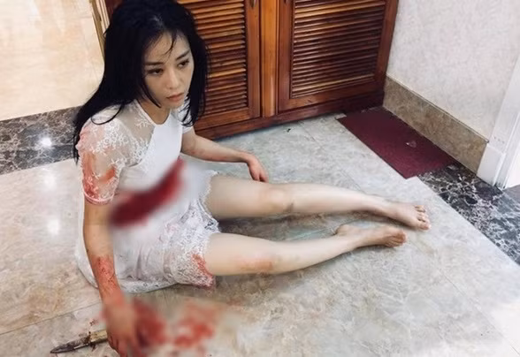 “Quynh bup be” bi dam be bet mau, du doan ket thuc tham