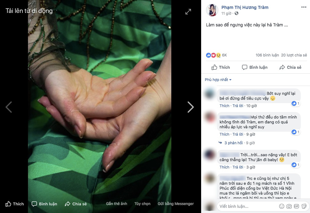 Huong Tram an y chuyen ap luc showbiz, stress tu boc tay ri mau-Hinh-3