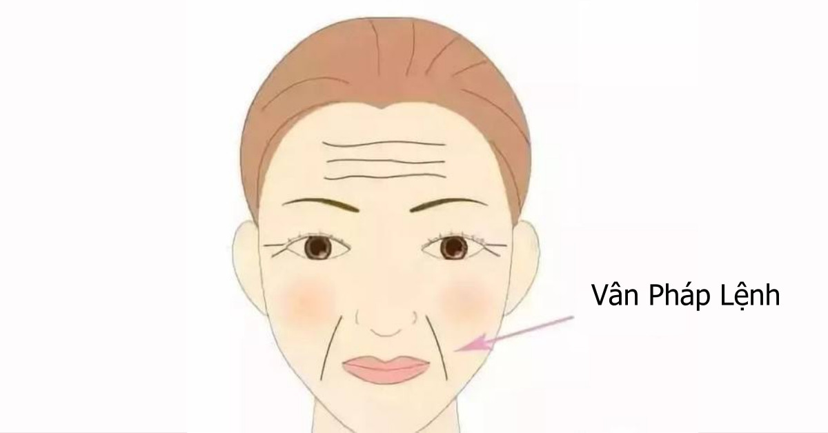 So huu 4 net tuong nay, dung voi ket hon som-Hinh-4