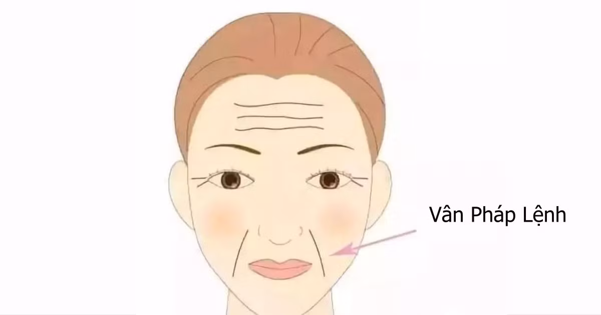 So huu 4 net tuong nay, dung voi ket hon som-Hinh-4