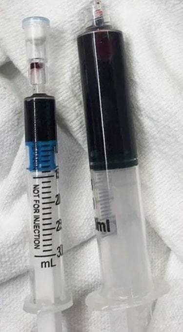 Ky la co gai co mau chuyen mau xanh khi uong thuoc dau rang-Hinh-2