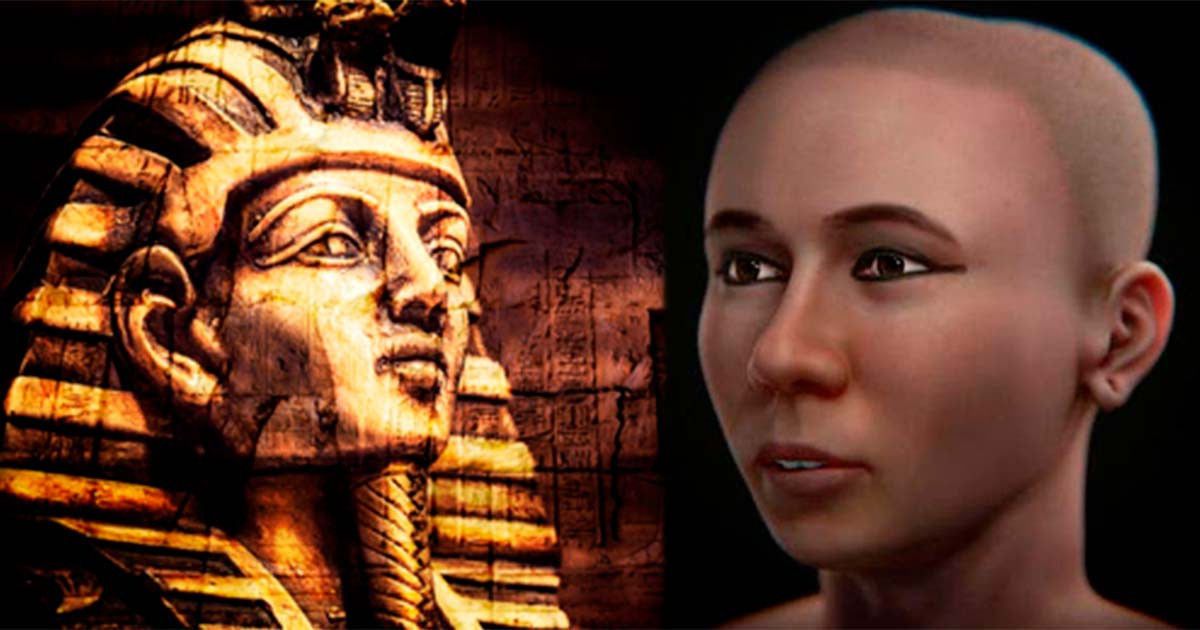 Kết quả chụp CT cho thấy pharaoh Tutankhamun bị gãy chân trái và nhiễm trùng. Trong khi đó, kết quả phân tích ADN hé lộ bằng chứng về việc Tutankhamun đã mắc bệnh nhiễm trùng sốt rét.