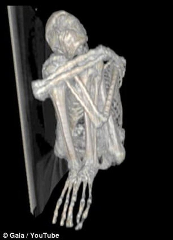 Từ những chi tiết trên, các nhà nghiên cứu suy đoán Maria có thể là một chủng người chưa từng được biết đến. Do giao phối cận huyết dẫn đến suy yếu gene nên Maria có bàn tay, chân chỉ 3 ngón và hộp sọ dài bất thường.