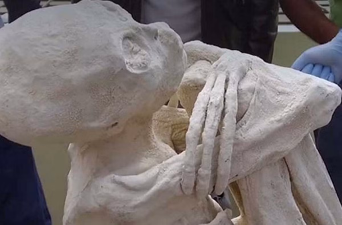 Năm 2017, các chuyên gia phát hiện một ngôi mộ có niên đại khoảng 6.500 tuổi ở cao nguyên Nazca, Peru. Khi khai quật, họ tìm thấy một xác ướp có 3 ngón tay, chân kỳ dị thay vì đủ 5 ngón như người bình thường.