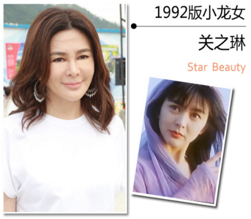 Quan Chi Lâm. Trong phiên bản Thần điêu đại hiệp: Si tâm tình kiếm do Hồng Kông sản xuất năm 1992, vai diễn Tiểu Long Nữ do nữ diễn viên xinh đẹp Quan Chi Lâm thể hiện. Quan Chi Lâm khi đó đã 30 tuổi nhưng cô vẫn sở hữu làn da trắng mịn, tươi tắn không khác một thiếu nữ. Nét đẹp trời phú từng khiến Quan Chi Lâm được mệnh danh là một trong Tứ đại mỹ nhân màn ảnh Hoa ngữ và lọt top 50 mỹ nhân đẹp nhất hành tinh do tạp chí People bình chọn năm 1998. Giờ đây nữ diễn viên đã ngoài 50 tuổi, cô bị nghi ngờ phẫu thuật thẩm mỹ vì làn da trông kém tự nhiên.