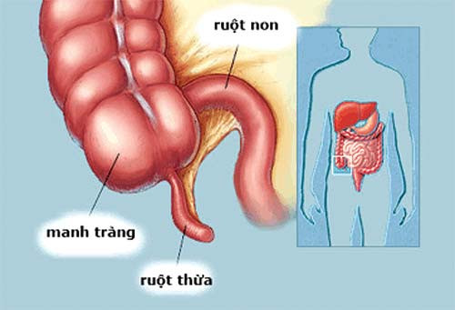 Ruột thừa. Ruột thừa là cơ quan thoái hóa, có nghĩa là nó đã mất hầu hết chức năng từ tổ tiên của mình. Có ý tưởng cho rằng, ruột thừa là phần còn lại của khoang lên men trong ruột chúng ta.