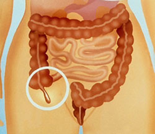 Nghiên cứu gần đây cũng chỉ ra, ruột thừa có thể là chỗ trú ngụ cần thiết cho các loại lợi khuẩn - các vi sinh rất quan trọng đối với chức năng tiêu hóa.