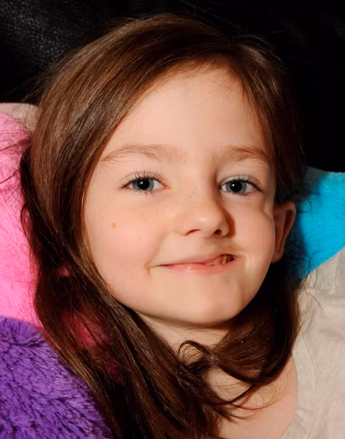 Bé gái khổ sở vì bệnh lạ khiến da mặt tự ăn mòn Be gai kho so vi benh la khien da mat tu an mon