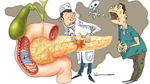 Đáng lưu ý, ung thư tuyến tụy thường có tiên lượng xấu ngay cả khi chẩn đoán sớm. Ung thư tuyến tụy thường lây lan nhanh và hiếm khi được phát hiện ở giai đoạn đầu. Đây là lý do tại sao ung thư tuyến tụy là một nguyên nhân tử vong hàng đầu ung thư.