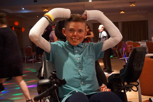 James Dunn năm nay 22 tuổi, đến từ Whiston, Merseyside (Anh). James được chẩn đoán mắc chứng bệnh da hiếm gặp bong biểu bì bullosa (RDEB) khiến làn da như bị bỏng độ ba, dễ trở nên phồng rộp và đau đớn chỉ vì cú chạm nhẹ.