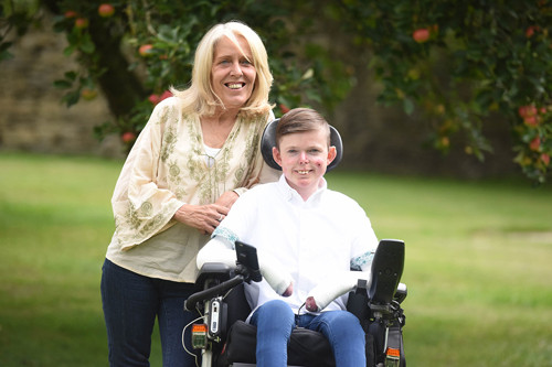 Dù luôn bị những cơn đau dày vò song James không cho phép mình chết mòn vì bệnh tật. Anh vẫn đảm nhiệm công việc quản trị nhân lực, tự lái xe và dành một vị trí danh dự trong đội bóng tại địa phương.