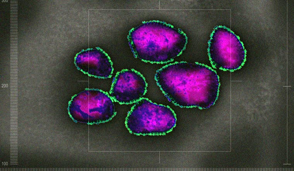 Đột biến giúp virus SARS-CoV-2 tăng khả năng né tránh hệ miễn dịch và lây lan nhanh hơn, dù mức độ cụ thể vẫn chưa rõ. Trước đó, K417N được tìm thấy trong biến chủng Beta, Gamma xuất hiện đầu tiên ở Nam Phi và Brazil, nên đặc điểm này cũng không hẳn là đáng lo ngại.