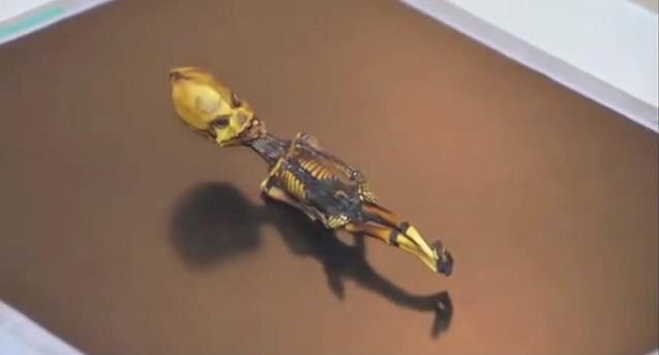 Các nhà nghiên cứu xác định 4 biến thể nucleotide đơn mới (SNV), một dạng đột biến gene, ở những gene gây ra các bệnh về xương như chứng vẹo cột sống hoặc trật khớp, cũng như hai SNV ở các gene liên quan đến sản sinh collagen. Mời các bạn xem video: Thụy Sĩ mở lớp dạy ngôn ngữ của người ngoài hành tinh. Nguồn: VTC.