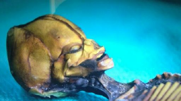 Tuy nhiên, sau khi phân tích ADN xác ướp, bộ xương thuộc về một đứa trẻ 6 - 8 tuổi dù kích thước của nó chỉ bằng một phôi thai. Ngoài chiều cao đặc biệt thấp, bộ xương còn có ít xương sườn hơn so với người bình thường và phần đầu hình nón.