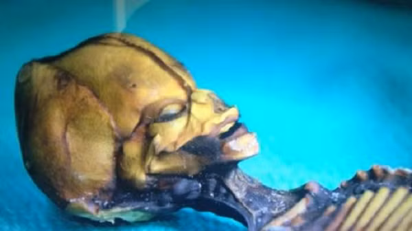 Tuy nhiên, sau khi phân tích ADN xác ướp, bộ xương thuộc về một đứa trẻ 6 - 8 tuổi dù kích thước của nó chỉ bằng một phôi thai. Ngoài chiều cao đặc biệt thấp, bộ xương còn có ít xương sườn hơn so với người bình thường và phần đầu hình nón.