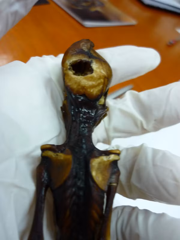 "Điều đáng chú ý khiến chúng tôi sớm đoán ra có gì đó khác lạ ở bộ xương là mức độ trưởng thành của các xương (mật độ và hình dáng)", Garry Nolan, giáo sư vi sinh vật học và miễn dịch học ở Trường y thuộc Đại học Stanford, California, cho biết.