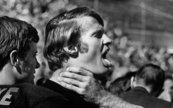 Trên thế giới cũng có những căn bệnh với triệu chứng tương tự với AHS về việc mất kiểm soát hành động nhưng AHS khác ở chỗ, những hành động của chân hay tay người bệnh thường đều có mục đích và được định hướng.