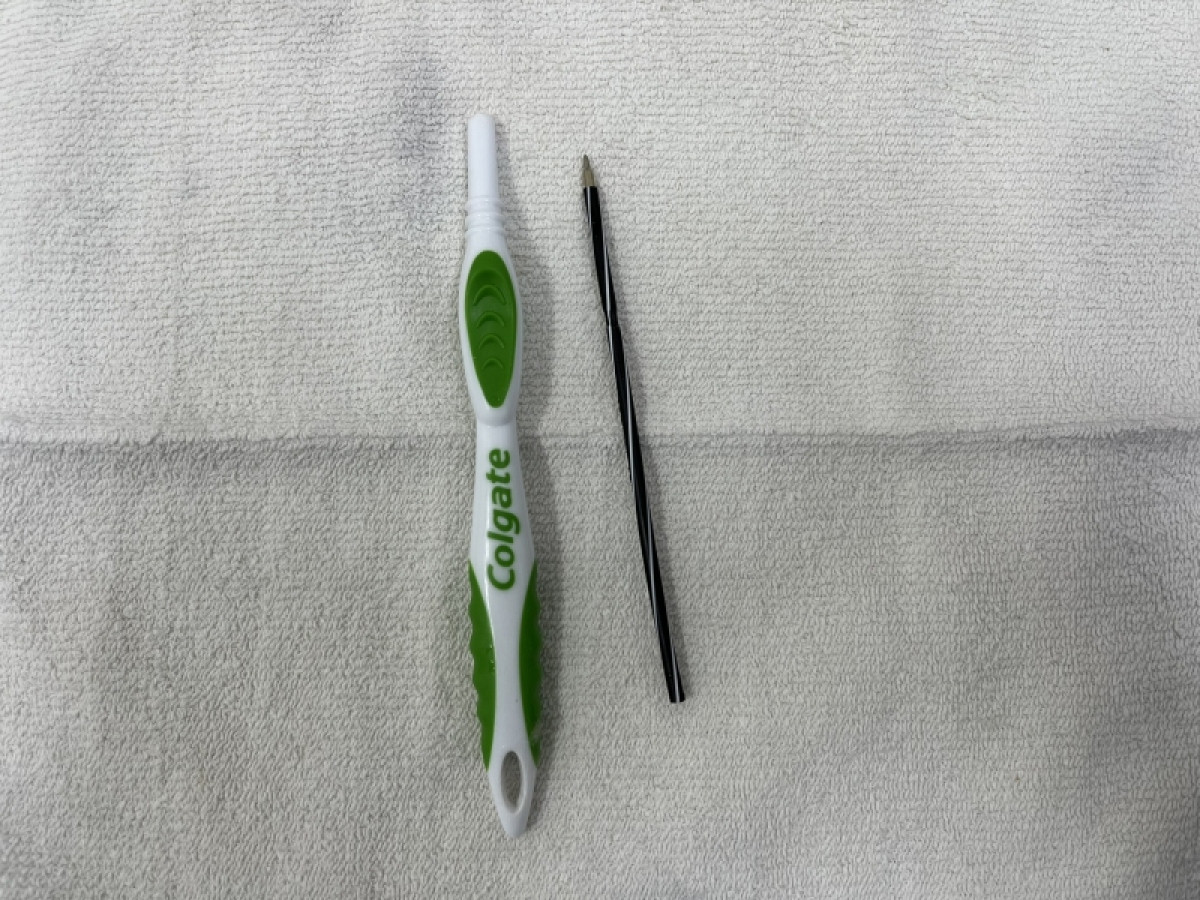 Nhieu nguoi nhap vien vi nuot ban chai danh rang: Bac si khuyen cao gi?-Hinh-3