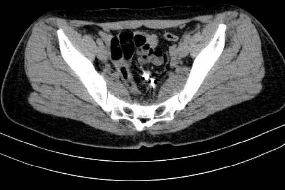 Thung tu cung, dai trang…vi vong tranh thai-Hinh-4