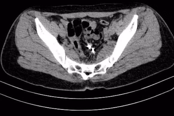 Thung tu cung, dai trang…vi vong tranh thai-Hinh-4