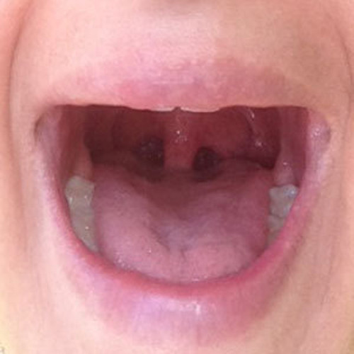 Bài 2. Đảo lưỡi. Dùng lưỡi đảo khắp miệng, làm sao cho tiếp xúc từng chiếc răng của mình. Tưởng tượng như đang dùng đầu lưỡi để khám từng chiếc răng trong miệng mình.