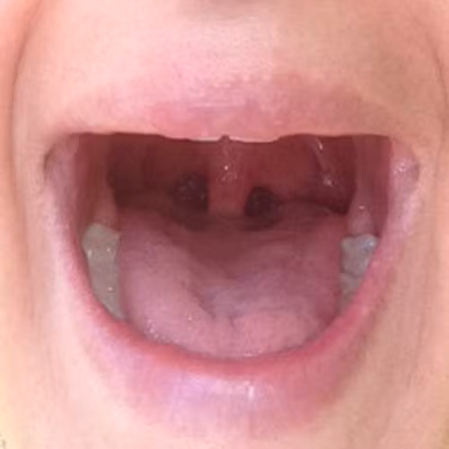 Bài 2. Đảo lưỡi. Dùng lưỡi đảo khắp miệng, làm sao cho tiếp xúc từng chiếc răng của mình. Tưởng tượng như đang dùng đầu lưỡi để khám từng chiếc răng trong miệng mình.