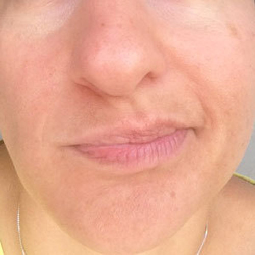 Bài 3. Nhai đều. Bất cứ khi nào ăn gì đó, hãy luôn nhớ đổi các bên hàm và nhai đều, chớ nên nhai một bên.