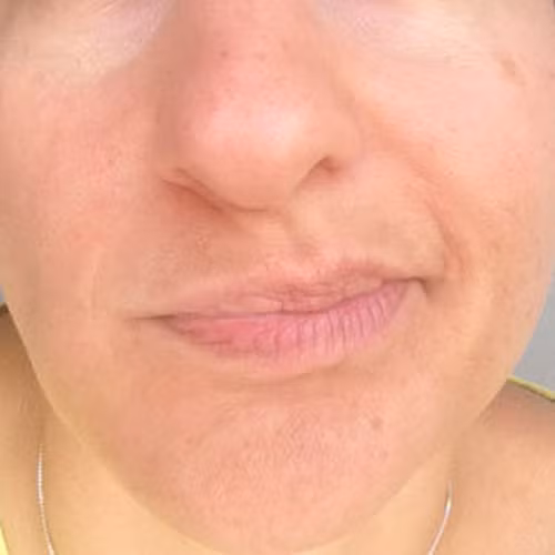 Bài 3. Nhai đều. Bất cứ khi nào ăn gì đó, hãy luôn nhớ đổi các bên hàm và nhai đều, chớ nên nhai một bên.