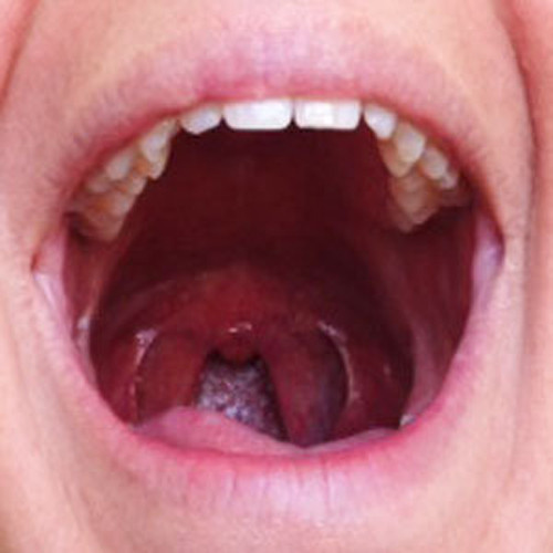 Bài 5. Nói Ahhhhhhhh. Bài tập này rất dễ dàng. Giống như bạn đi khám răng, há vòm miệng rộng và nói chữ A. Lặp đi lặp lại động tác này.