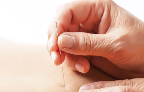 Châm cứu. Đây là hình thức y học của Trung Quốc có nhiều ưu việt trong y tế. Tuy nhiên, hình thức này cũng liên quan đến việc sử dụng kim tiêm. Điều này khiến bạn có nguy cơ cao bị nhiễm bệnh viêm gan.