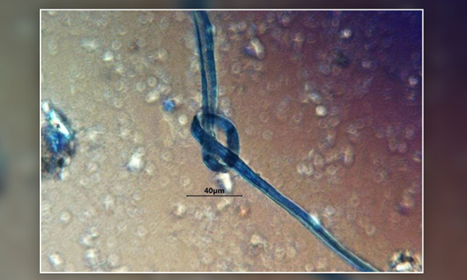 Mới đây, các chuyên gia công bố kết quả nghiên cứu đáng chú ý về những bộ hài cốt này. Cụ thể, họ nghiên cứu các mảng bám vôi hóa trên răng, còn gọi là cao răng ở những nạn nhân hiến tế.