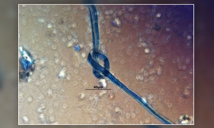 Mới đây, các chuyên gia công bố kết quả nghiên cứu đáng chú ý về những bộ hài cốt này. Cụ thể, họ nghiên cứu các mảng bám vôi hóa trên răng, còn gọi là cao răng ở những nạn nhân hiến tế.