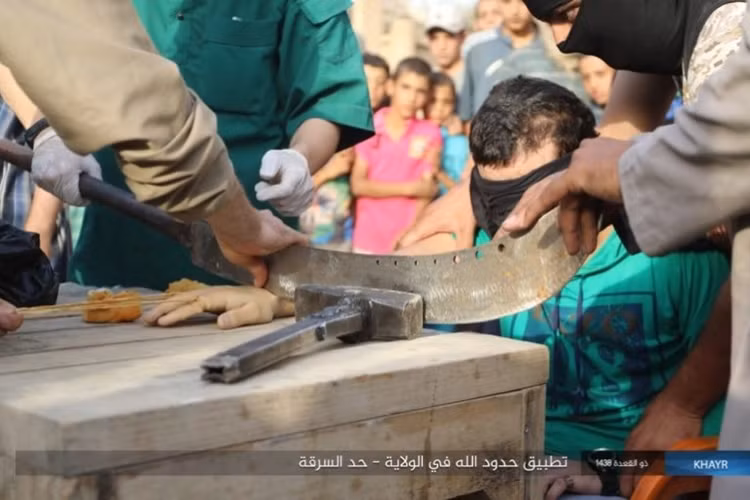 ...bằng hình thức chặt bàn tay... Ảnh: Al Masdar News