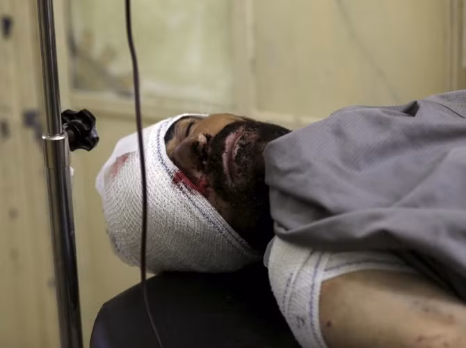 Một người bị thương trong vụ đánh bom ngày 7/8. Lực lượng Taliban đã lên tiếng nhận trách nhiệm trong vụ đánh bom vào Học viện cảnh sát Kabul làm thương vong 60 người.